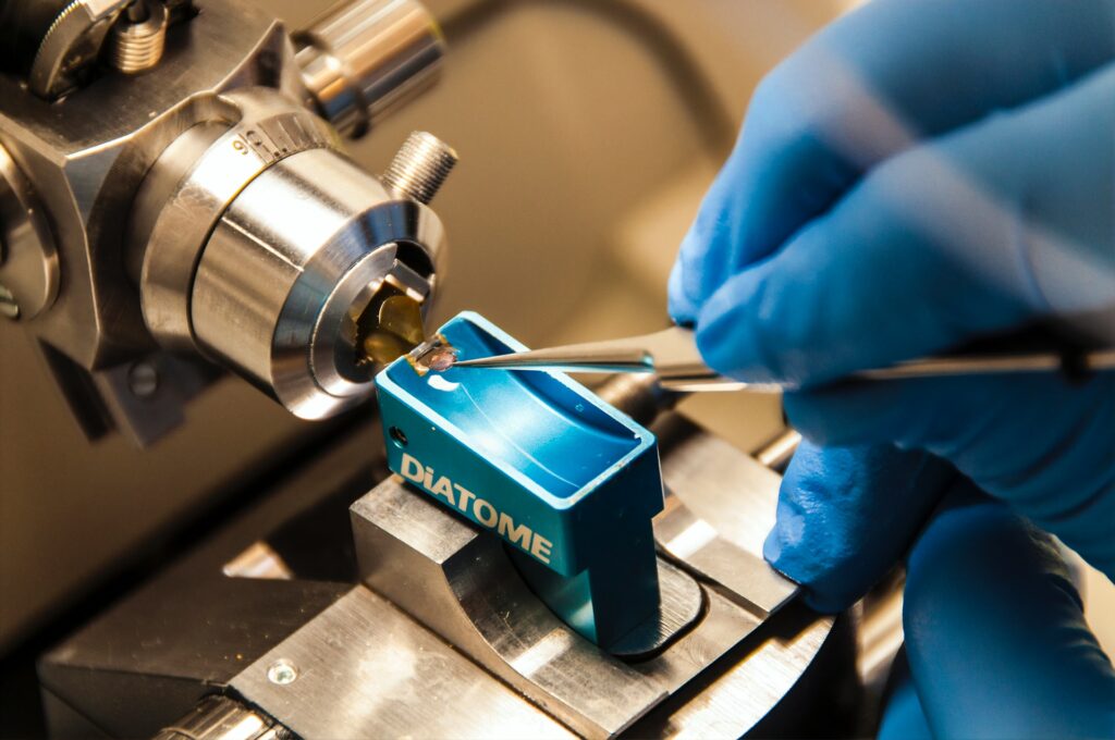 oncogene testing RET lung cancer